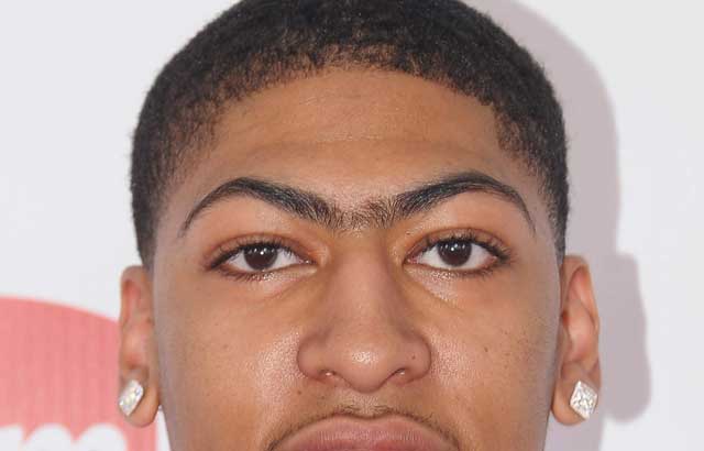 Anthony Davis Unibrow