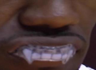 [Image: lebron-james-fangs-mouth-gu.jpg]