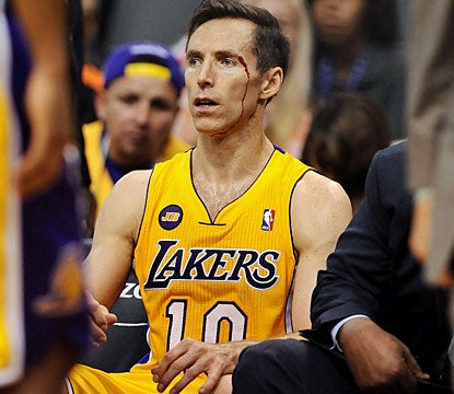 Steve Nash scores 19 points against his former team, and also comes away bloody in a losing effort. (USATSI)