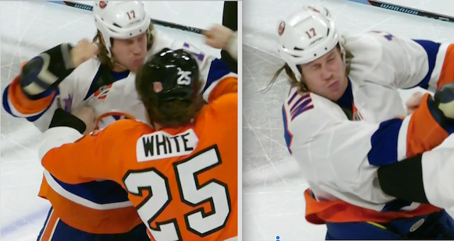 Matt Martin's nose, before and after. (Comcast Sports Net)
