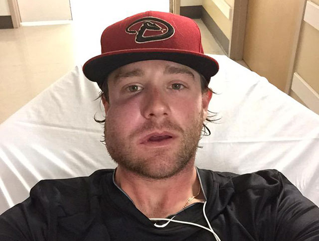 Archie Bradley walks away OK after being struck in face with line