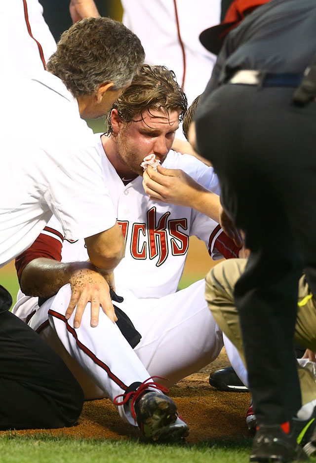 Archie Bradley Injury: Updates on Diamondbacks Pitcher After Line Drive to  Face, News, Scores, Highlights, Stats, and Rumors