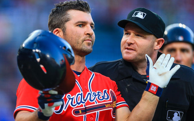 Braves' Dan Uggla set for eye surgery, could miss up to a month